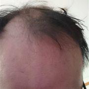 ハゲてきたのはお前のせいだ！さんのアイコン